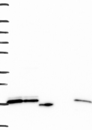 Anti-RPS24 Antibody