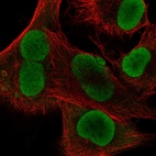 Immunofluorescent staining of human cell line SK-MEL-30 shows localization to nucleoplasm.