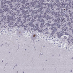 Anti-LHX1 Antibody