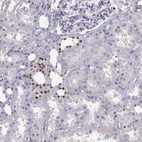 Immunohistochemical staining of human kidney shows strong nuclear positivity in cells in distal tubules.