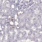 Immunohistochemical staining of human kidney shows strong nuclear positivity in cells in distal tubules.