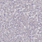 Immunohistochemical staining of human liver shows no nuclear positivity in hepatocytes as expected.