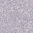 Immunohistochemical staining of human liver shows no nuclear positivity in hepatocytes as expected.