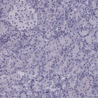 Immunohistochemical staining of human pancreas shows no nuclear positivity in exocrine glandular cells as expected.