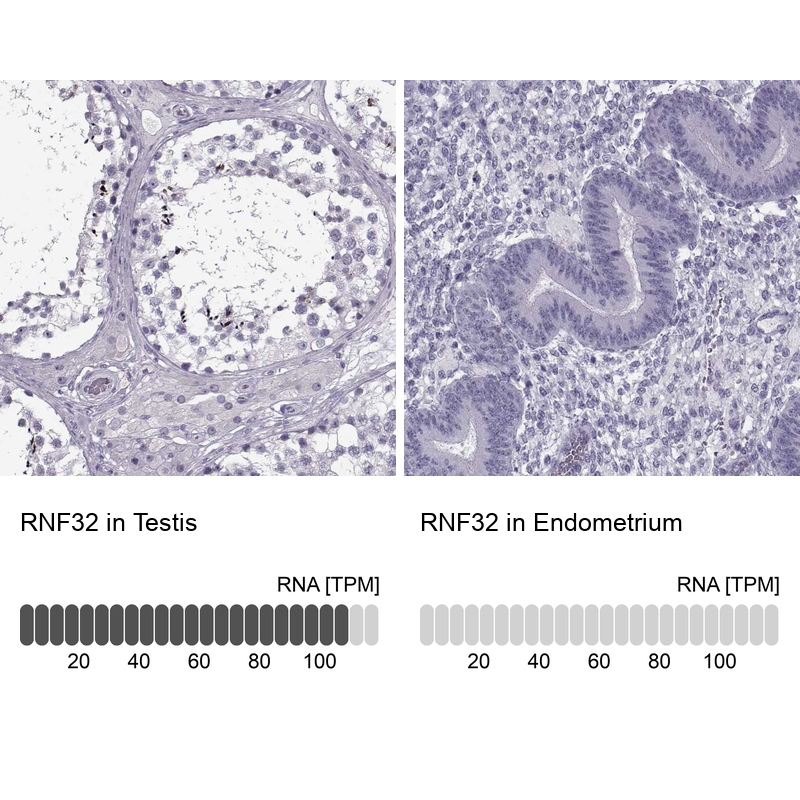 Anti-RNF32 Antibody