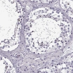 Immunohistochemical staining of human testis shows high expression.