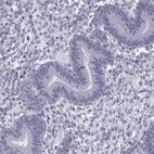 Immunohistochemical staining of human endometrium shows low expression as expected.