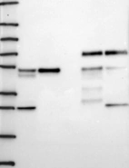 Lane 1: Marker [kDa] 250, 130, 95, 72, 55, 36, 28, 17, 10 | Lane 2: RT4 | Lane 3: U-251 MG | Lane 4: Human Plasma | Lane 5: Liver | Lane 6: Tonsil