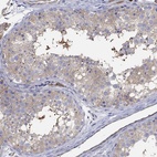 Immunohistochemical staining of human testis shows high expression.