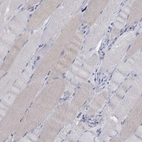 Immunohistochemical staining of human skeletal muscle shows low expression as expected.