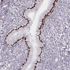 Anti-MSX1 Antibody