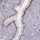 Immunohistochemical staining of human cervix, uterine shows high expression.