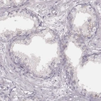 Immunohistochemical staining of human prostate shows low expression as expected.