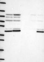 Lane 1: Marker [kDa] 250, 130, 95, 72, 55, 36, 28, 17, 10 | Lane 2: RT4 | Lane 3: U-251 MG | Lane 4: Human Plasma | Lane 5: Liver | Lane 6: Tonsil