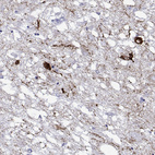 Anti-HTR7 Antibody
