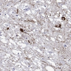 Anti-HTR7 Antibody