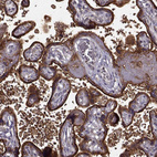 Immunohistochemical staining of human placenta shows strong granular cytoplasmic positivity in trophoblastic cells.