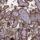 Immunohistochemical staining of human placenta shows strong granular cytoplasmic positivity in trophoblastic cells.
