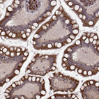 Immunohistochemical staining of human small intestine shows strong granular cytoplasmic positivity in glandular cells.