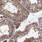 Immunohistochemical staining of human testis shows strong granular cytoplasmic positivity in cells in seminiferous ducts.