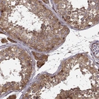 Immunohistochemical staining of human testis shows strong granular cytoplasmic positivity in cells in seminiferous ducts.