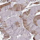 Immunohistochemical staining of human skeletal muscle shows moderate cytoplasmic positivity in myocytes.