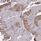 Immunohistochemical staining of human skeletal muscle shows moderate cytoplasmic positivity in myocytes.