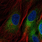 Immunofluorescent staining of human cell line BJ shows localization to endoplasmic reticulum & vesicles.