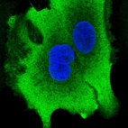 Anti-AKR1B10 Antibody