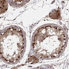 Anti-DEDD Antibody