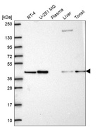 Western blot analysis in human cell line RT-4, human cell line U-251 MG, human plasma, human liver tissue and human tonsil tissue.