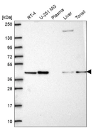 Western blot analysis in human cell line RT-4, human cell line U-251 MG, human plasma, human liver tissue and human tonsil tissue.