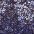 Immunohistochemical staining of human thymus shows cytoplasmc positivity in cortical and medullary cells.