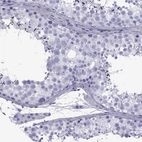 Anti-SPANXD Antibody