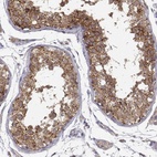 Anti-PAIP1 Antibody