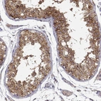Anti-PAIP1 Antibody
