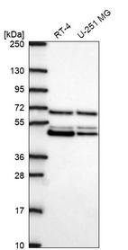 Western blot analysis in human cell line RT-4 and human cell line U-251 MG.