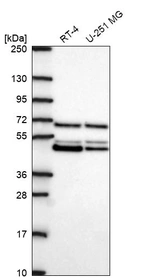 Western blot analysis in human cell line RT-4 and human cell line U-251 MG.