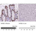 Anti-SATB2 Antibody