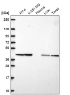 Western blot analysis in human cell line RT-4, human cell line U-251 MG, human plasma, human liver tissue and human tonsil tissue.