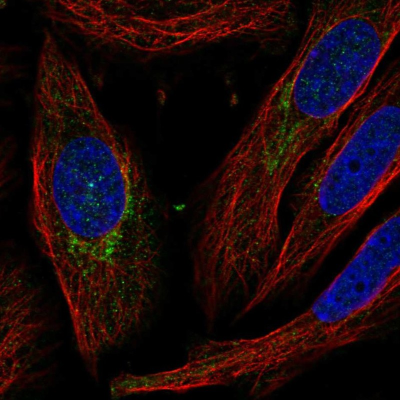Anti-C5orf38 Antibody
