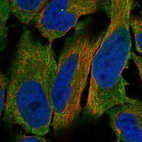 Anti-LHCGR Antibody