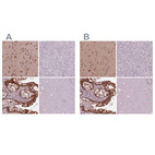 Immunohistochemical staining of human cerebral cortex, liver, rectum and skeletal muscle using Anti-SRI antibody HPA073666 (A) shows similar protein distribution across tissues to independent antibody HPA019004 (B).