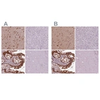 Immunohistochemical staining of human cerebral cortex, liver, rectum and skeletal muscle using Anti-SRI antibody HPA073666 (A) shows similar protein distribution across tissues to independent antibody HPA019004 (B).