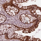 Immunohistochemical staining of human rectum shows strong cytoplasmic and membranous positivity in glandular cells.