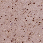 Immunohistochemical staining of human cerebral cortex shows strong cytoplasmic positivity in glial cells.