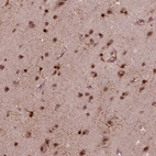 Immunohistochemical staining of human cerebral cortex shows strong cytoplasmic positivity in glial cells.