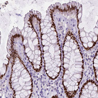 Immunohistochemical staining of human rectum shows strong nuclear positivity in glandular cells.