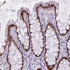 Anti-SATB2 Antibody