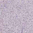 Immunohistochemical staining of human liver shows no cytoplasmic positivity in hepatocytes as expected.
